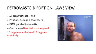 PETROMASTOID PORTION- LAWS VIEW
• AXIOLATERAL OBLIQUE
• Position- head in a true lateral.
• IOML parallel to cassette.
• Central ray -Directed at an angle of
15 degrees caudad and 15 degrees
anteriorly
 