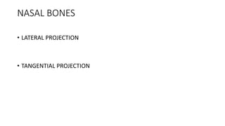 NASAL BONES
• LATERAL PROJECTION
• TANGENTIAL PROJECTION
 