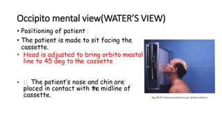 Occipito mental view(WATER’S VIEW)
• Positioning of patient :
• The patient is made to sit facing the
cassette.
• Head is adjusted to bring orbito meatal
line to 45 deg to the cassette
• The patient’s nose and chin are
placed in contact with the midline of
cassette.
 