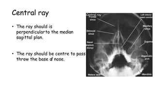 Central ray
• The ray should is
perpendicularto the median
sagittal plan.
• The ray should be centre to pass
throw the base of nose.
Central ray
 