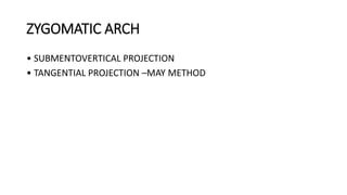 ZYGOMATIC ARCH
• SUBMENTOVERTICAL PROJECTION
• TANGENTIAL PROJECTION –MAY METHOD
 