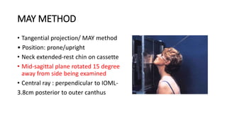MAY METHOD
• Tangential projection/ MAY method
• Position: prone/upright
• Neck extended-rest chin on cassette
• Mid-sagittal plane rotated 15 degree
away from side being examined
• Central ray : perpendicular to IOML-
3.8cm posterior to outer canthus
 