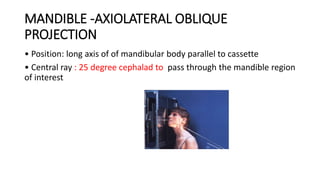 MANDIBLE -AXIOLATERAL OBLIQUE
PROJECTION
• Position: long axis of of mandibular body parallel to cassette
• Central ray : 25 degree cephalad to pass through the mandible region
of interest
 