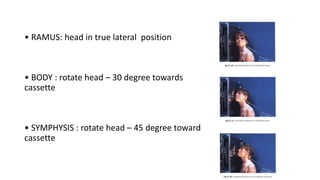 • RAMUS: head in true lateral position
• BODY : rotate head – 30 degree towards
cassette
• SYMPHYSIS : rotate head – 45 degree toward
cassette
 