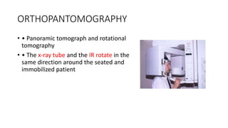 ORTHOPANTOMOGRAPHY
• • Panoramic tomograph and rotational
tomography
• • The x-ray tube and the IR rotate in the
same direction around the seated and
immobilized patient
 