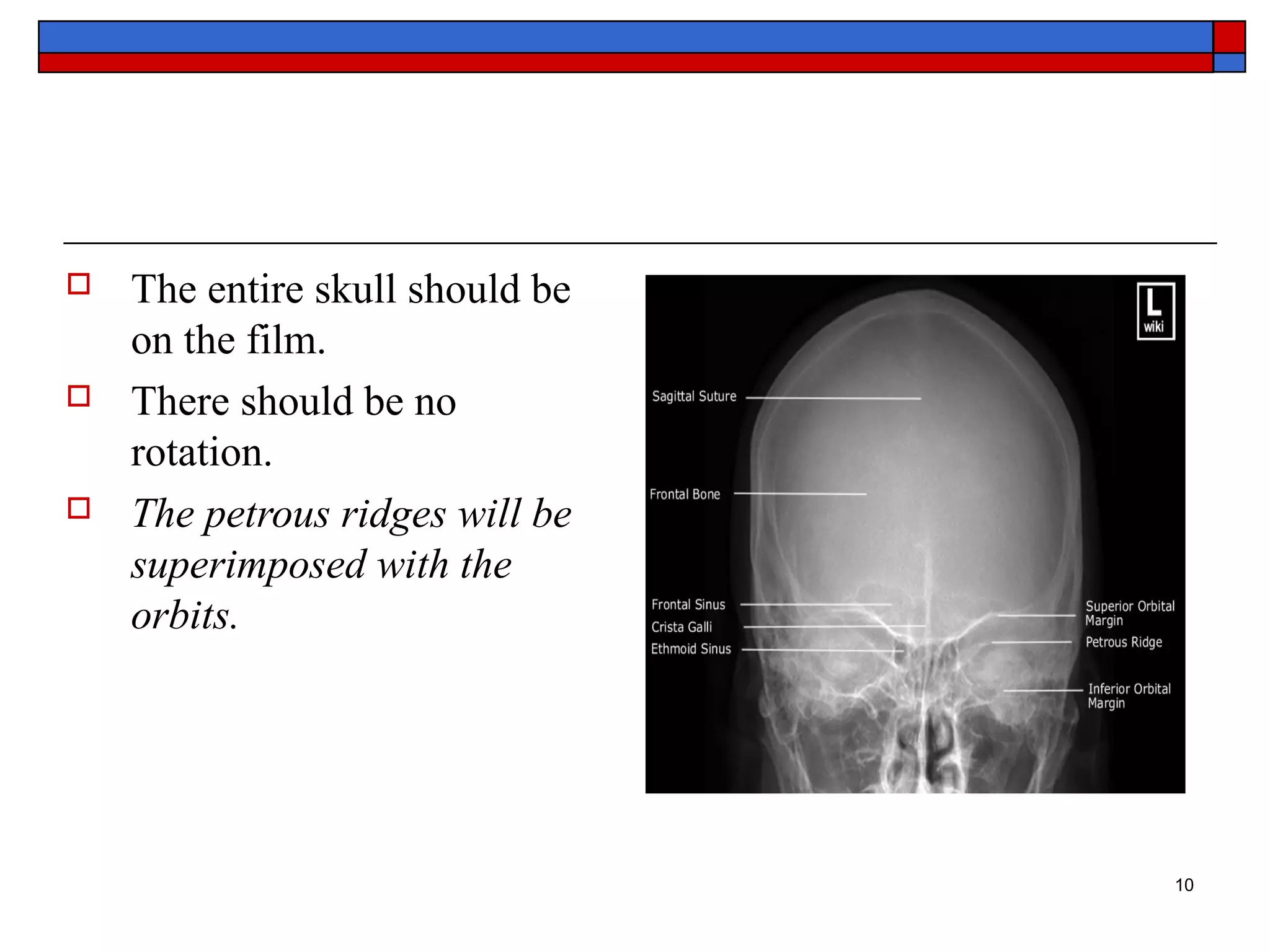 Basic anatomy Views importance and positioning Interpretation Skull