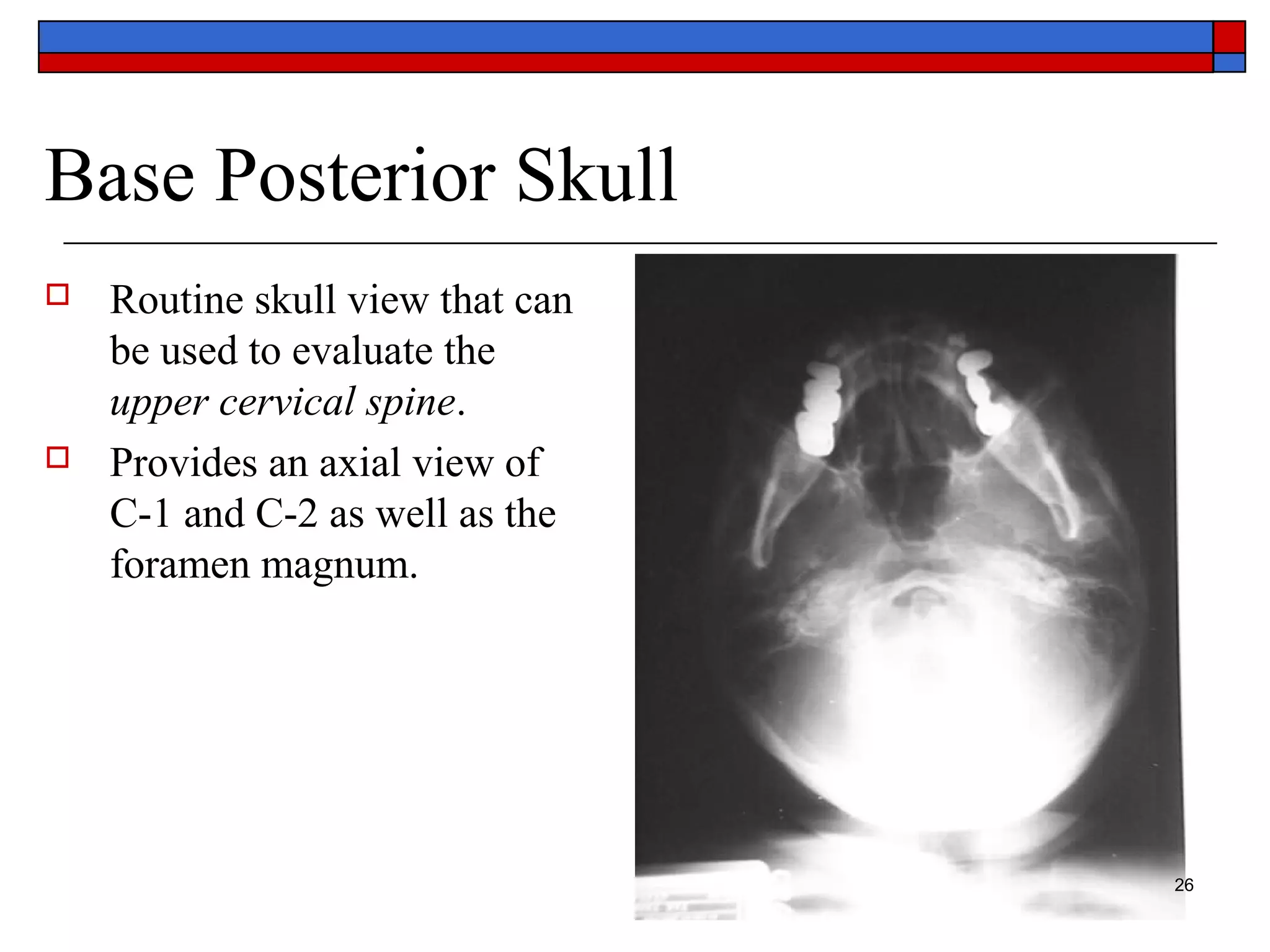Basic anatomy Views importance and positioning Interpretation Skull