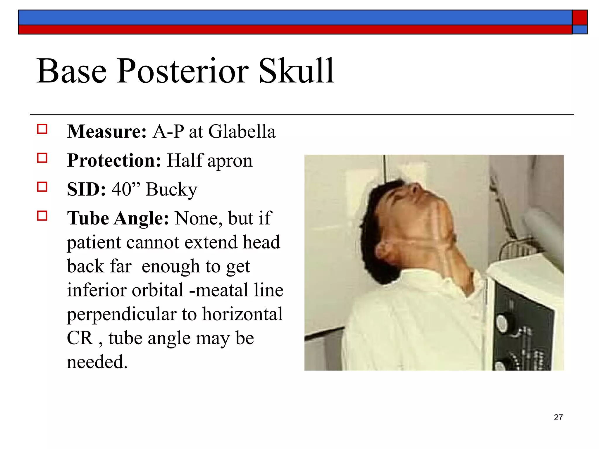 Basic anatomy Views importance and positioning Interpretation Skull