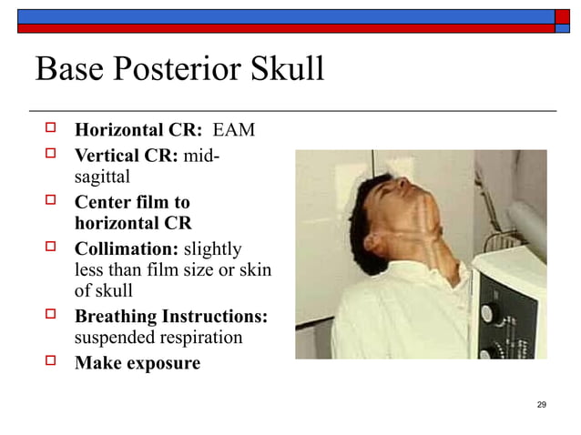 Roberts View Radiographs Basic anatomy Views -importance and positioning Interpretation Skull ...