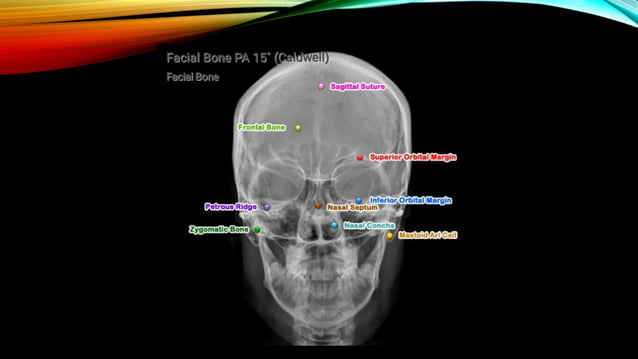 skull radiography - Ayush Gupta (BRT, MRIT) | PPT