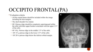Petrous Ridge Positioning Chart Radiography of Skull, Facial Bones and Sinuses | PPTX