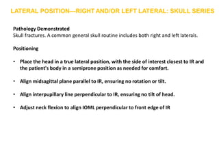 Pathology Demonstrated
Skull fractures. A common general skull routine includes both right and left laterals.
Positioning
• Place the head in a true lateral position, with the side of interest closest to IR and
the patient's body in a semiprone position as needed for comfort.
• Align midsagittal plane parallel to IR, ensuring no rotation or tilt.
• Align interpupillary line perpendicular to IR, ensuring no tilt of head.
• Adjust neck flexion to align IOML perpendicular to front edge of IR
 