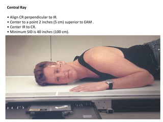 Central Ray
• Align CR perpendicular to IR.
• Center to a point 2 inches (5 cm) superior to EAM .
• Center IR to CR.
• Minimum SID is 40 inches (100 cm).
 