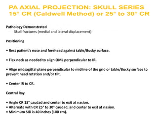 Pathology Demonstrated
Skull fractures (medial and lateral displacement)
Positioning
• Rest patient's nose and forehead against table/Bucky surface.
• Flex neck as needed to align OML perpendicular to IR.
• Align midsagittal plane perpendicular to midline of the grid or table/Bucky surface to
prevent head rotation and/or tilt.
• Center IR to CR.
Central Ray
• Angle CR 15° caudad and center to exit at nasion.
• Alternate with CR 25° to 30° caudad, and center to exit at nasion.
• Minimum SID is 40 inches (100 cm).
 