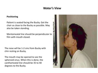 Water’s View
Positioning
Patient is seated facing the Bucky. Get the
chair as close to the Bucky as possible. May
also be taken standing.
Mentomeatal line should be perpendicular to
film with mouth closed.
The nose will be 1-2 cms from Bucky with
chin resting on Bucky.
The mouth may be opened to see the
sphenoid sinus. When this is done, the
canthomeatal line should be 35 to 40
degrees to the Bucky.
 