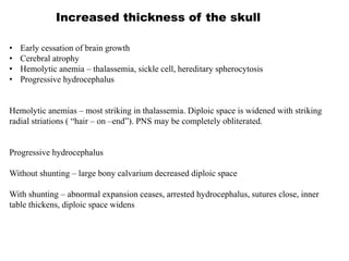 Increased thickness of the skull
• Early cessation of brain growth
• Cerebral atrophy
• Hemolytic anemia – thalassemia, sickle cell, hereditary spherocytosis
• Progressive hydrocephalus
Hemolytic anemias – most striking in thalassemia. Diploic space is widened with striking
radial striations ( “hair – on –end”). PNS may be completely obliterated.
Progressive hydrocephalus
Without shunting – large bony calvarium decreased diploic space
With shunting – abnormal expansion ceases, arrested hydrocephalus, sutures close, inner
table thickens, diploic space widens
 