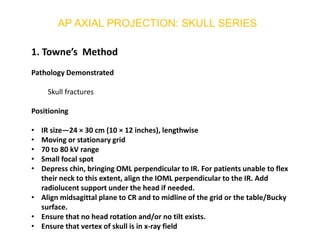 1. Towne’s Method
Pathology Demonstrated
Skull fractures
Positioning
• IR size—24 × 30 cm (10 × 12 inches), lengthwise
• Moving or stationary grid
• 70 to 80 kV range
• Small focal spot
• Depress chin, bringing OML perpendicular to IR. For patients unable to flex
their neck to this extent, align the IOML perpendicular to the IR. Add
radiolucent support under the head if needed.
• Align midsagittal plane to CR and to midline of the grid or the table/Bucky
surface.
• Ensure that no head rotation and/or no tilt exists.
• Ensure that vertex of skull is in x-ray field
 