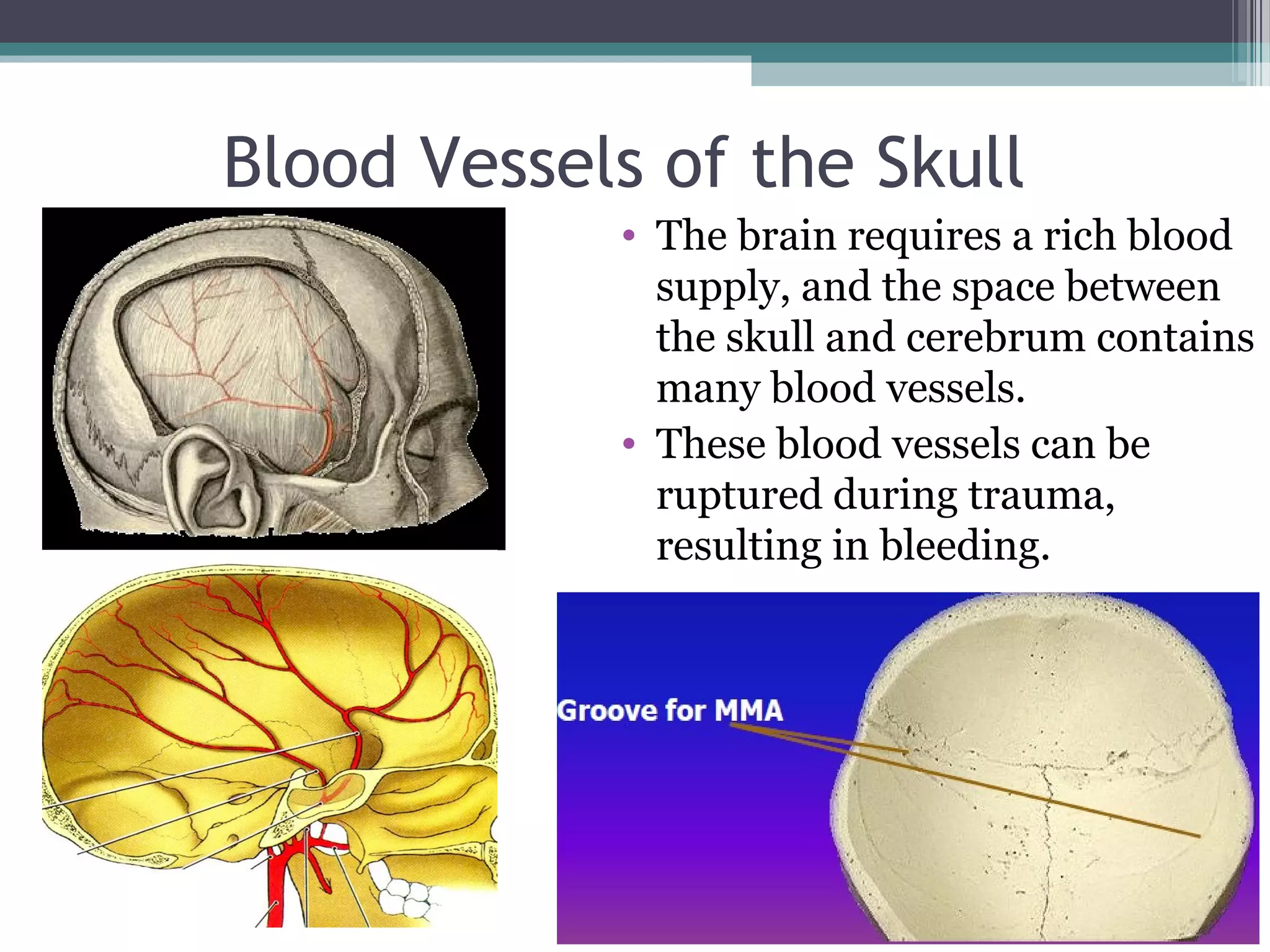 Blood Vessels of the Skull
• The brain requires a rich blood
supply, and the space between
the skull and cerebrum contains
many blood vessels.
• These blood vessels can be
ruptured during trauma,
resulting in bleeding.
 