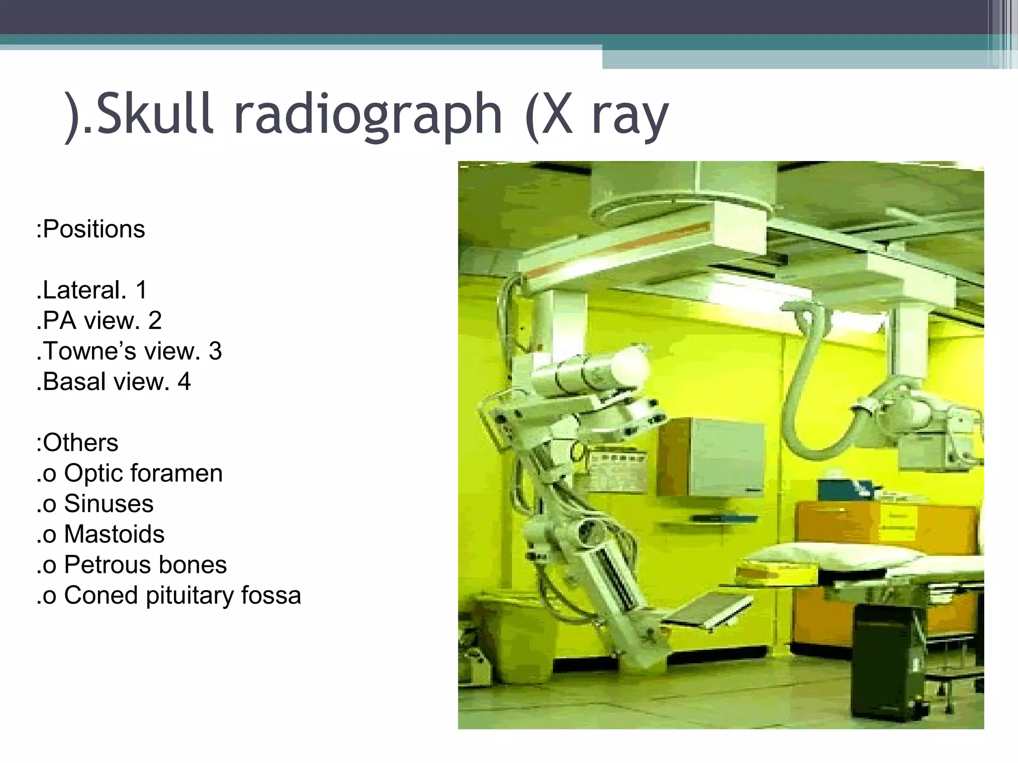 Skull radiograph (X ray(.
Positions:
1.Lateral.
2.PA view.
3.Towne’s view.
4.Basal view.
Others:
o Optic foramen.
o Sinuses.
o Mastoids.
o Petrous bones.
o Coned pituitary fossa.
 