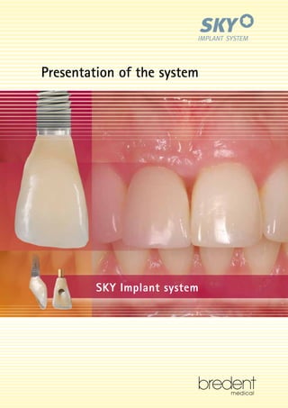 Presentation of the system

SKY Implant system

 