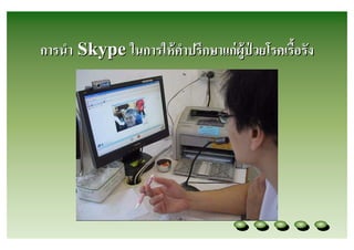 การนํา Skype ในการให้ คาปรึกษาแก่ ผู้ป่วยโรคเรือรัง
                       ํ
 
