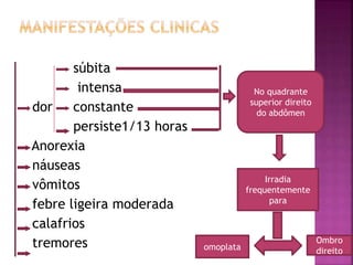 súbita
intensa
dor constante
persiste1/13 horas
Anorexia
náuseas
vômitos
febre ligeira moderada
calafrios
tremores
No quadrante
superior direito
do abdômen
Irradia
frequentemente
para
omoplata
Ombro
direito
 