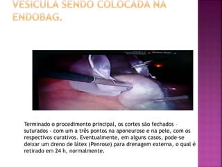 Terminado o procedimento principal, os cortes são fechados –
suturados - com um a três pontos na aponeurose e na pele, com os
respectivos curativos. Eventualmente, em alguns casos, pode-se
deixar um dreno de látex (Penrose) para drenagem externa, o qual é
retirado em 24 h, normalmente.
 