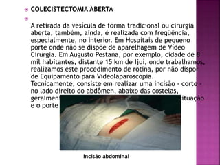  COLECISTECTOMIA ABERTA

A retirada da vesícula de forma tradicional ou cirurgia
aberta, também, ainda, é realizada com freqüência,
especialmente, no interior. Em Hospitais de pequeno
porte onde não se dispõe de aparelhagem de Vídeo
Cirurgia. Em Augusto Pestana, por exemplo, cidade de 8
mil habitantes, distante 15 km de Ijuí, onde trabalhamos,
realizamos este procedimento de rotina, por não dispor
de Equipamento para Videolaparoscopia.
Tecnicamente, consiste em realizar uma incisão - corte -
no lado direito do abdômen, abaixo das costelas,
geralmente em torno de 10 a 20 cm, conforme a situação
e o porte físico do paciente (foto abaixo).
Incisão abdominal
 