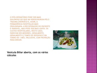 Vesícula Biliar aberta, com os vários
cálculos
 
