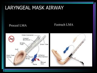 LARYNGEAL MASK AIRWAY Proceal LMA Fastrach LMA 