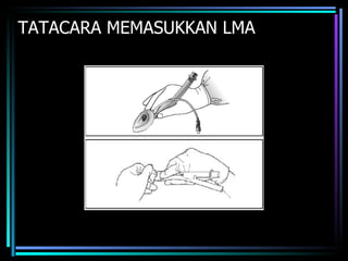 TATACARA MEMASUKKAN LMA 