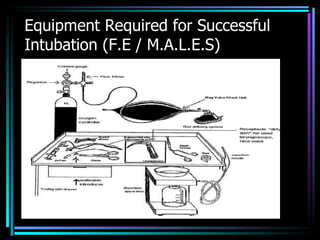 Equipment Required for Successful Intubation (F.E / M.A.L.E.S) 