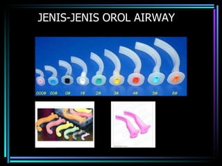 JENIS-JENIS OROL AIRWAY 
