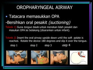 OROPHARYNGEAL AIRWAY Tatacara memasukkan OPA -Bersihkan oral pesakit  (suctioning) Teknik 1)  Guna  tongue blade  untuk menekan lidah pesakit dan masukan OPA ke belakang (disarankan untuk infant).   Teknik 2)  Insert the oral airway upside down until the soft  palate is reached.  Rotate the device 180 degrees and slip it over the tongue. step 1  step 2  step 3  st ep 4 