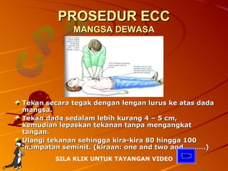 PROSEDUR ECC
             MANGSA DEWASA




Tekan secara tegak dengan lengan lurus ke atas dada
mangsa.
Tekan dada sedalam lebih kurang 4 – 5 cm,
kemudian lepaskan tekanan tanpa mengangkat
tangan.
Ulangi tekanan sehingga kira-kira 80 hingga 100
mampatan seminit. (kiraan: one and two and ………)
        SILA KLIK UNTUK TAYANGAN VIDEO
 