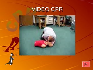 VIDEO CPR
 