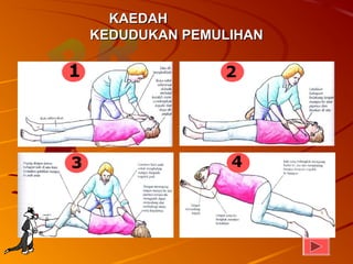 KAEDAH
    KEDUDUKAN PEMULIHAN

1                 2




3                  4
 