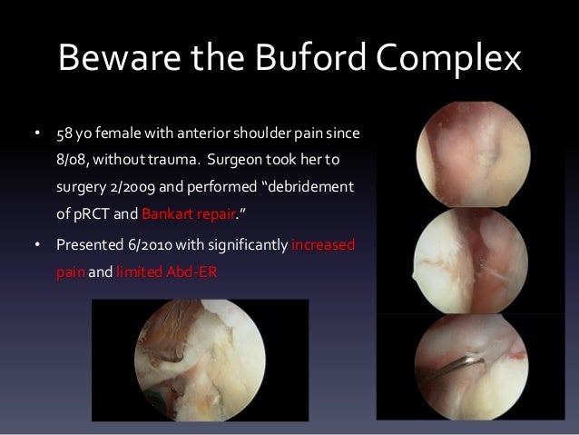 slap lesion case study