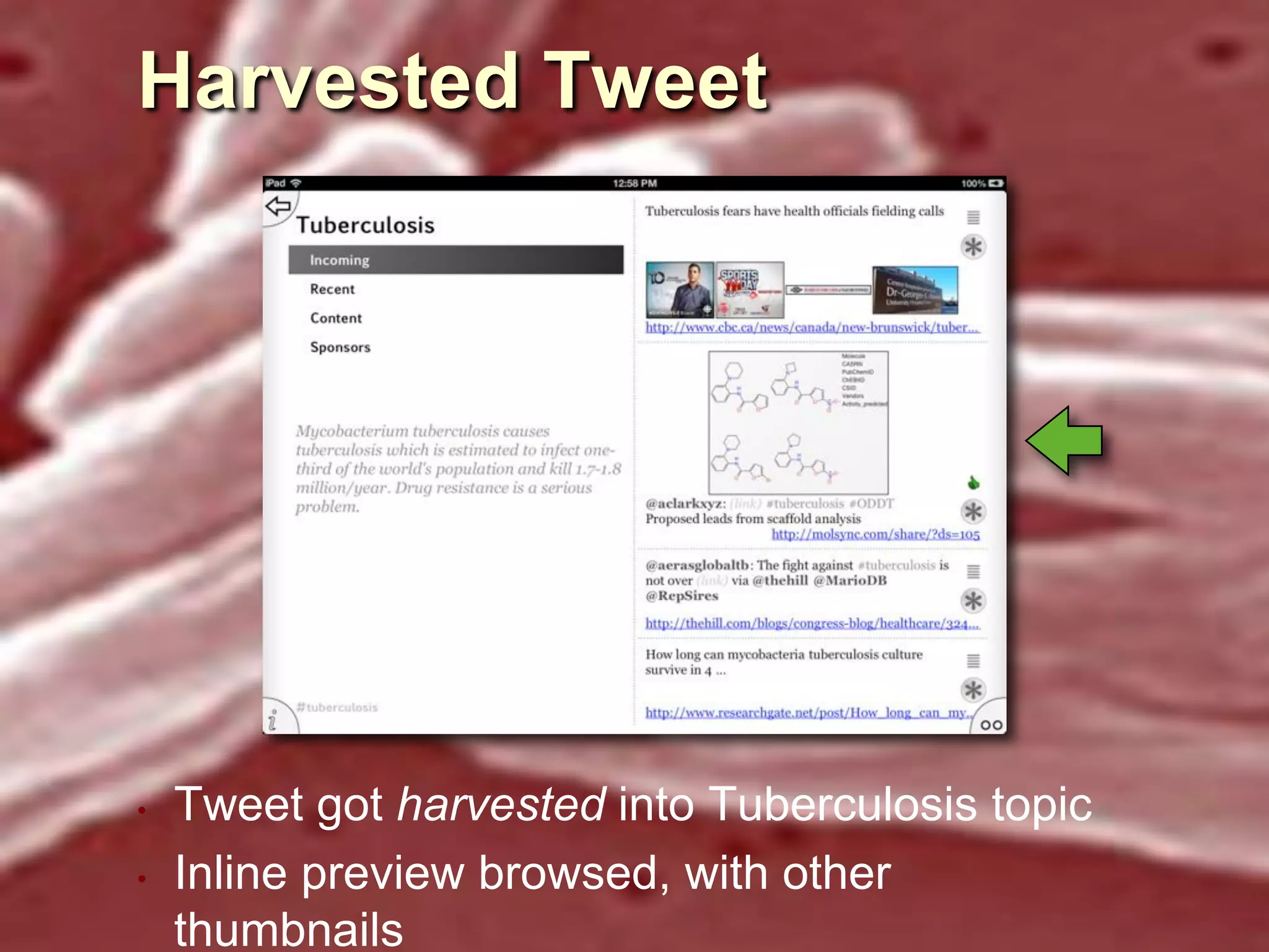 Harvested Tweet

•
•

Tweet got harvested into Tuberculosis topic
Inline preview browsed, with other
thumbnails

 