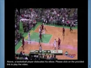 Above, a basketball player dislocates his elbow. Please click on the provided
link to play the video.
                                                                                1
 