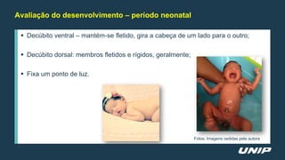 Avaliação do desenvolvimento – período neonatal
 Decúbito ventral – mantém-se fletido, gira a cabeça de um lado para o outro;
 Decúbito dorsal: membros fletidos e rígidos, geralmente;
 Fixa um ponto de luz.
Fotos: Imagens cedidas pela autora
 