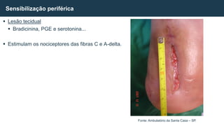  Lesão tecidual
 Bradicinina, PGE e serotonina...
 Estimulam os nociceptores das fibras C e A-delta.
Sensibilização periférica
Fonte: Ambulatório da Santa Casa – SP.
 