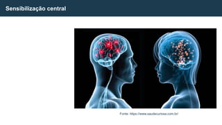 Sensibilização central
Fonte: https://www.saudecuriosa.com.br/
 