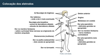 Colocação dos eletrodos
Fonte: Livro-texto.
A) Neuralgia do trigêmeo
Dor talâmica
- onde a dor é mais acentuada
Neuralgia pós-herpética
- acima do dermátomo afetado
- através do dermátomo afetado
Dor no membro fantasma
- sobre o principal feixe nervoso se originando do
membro amputado
Dismenorreia (mulheres)
Dor no joelho (osteoartrite)
- dois canais se apropriado
Dor no tornozelo
Ombro anterior
Angina
Metástase em costela
Dor pós-operatória
- eletrodos grandes se
apropriado
Dor no membro fantasma
- nervo mediano
contralateral
Dor pós-operatória (veia
safena)
- eletrodos grandes se
apropriado
 