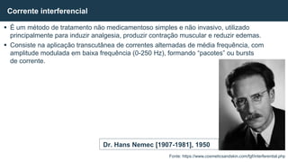  É um método de tratamento não medicamentoso simples e não invasivo, utilizado
principalmente para induzir analgesia, produzir contração muscular e reduzir edemas.
 Consiste na aplicação transcutânea de correntes alternadas de média frequência, com
amplitude modulada em baixa frequência (0-250 Hz), formando “pacotes” ou bursts
de corrente.
Corrente interferencial
Fonte: https://www.cosmeticsandskin.com/fgf/interferential.php
Dr. Hans Nemec [1907-1981], 1950
 