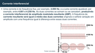  Uma corrente é de frequência fixa, por exemplo, 4.000 Hz, e a outra corrente ajustável, por
exemplo, entre 4.001 e 4.250 Hz. As duas correntes se somam ou se cancelam, produzindo
a corrente interferencial de amplitude modulada resultante (AMF). A frequência da
corrente resultante será igual à média das duas correntes originais e sofrerá variação em
amplitude com uma frequência igual à diferença entre essas duas correntes.
Corrente interferencial
Fonte: Livro-texto.
4000 Hz
4100 Hz
4050 Hz
Voltage
or
current
+
0
-
10 ms
 