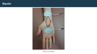 Bipolar
Fonte: Livro-texto.
 