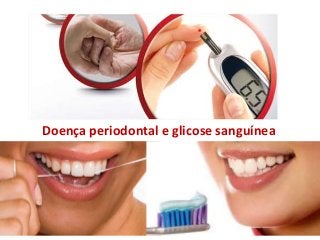 Doença periodontal e glicose sanguínea
 