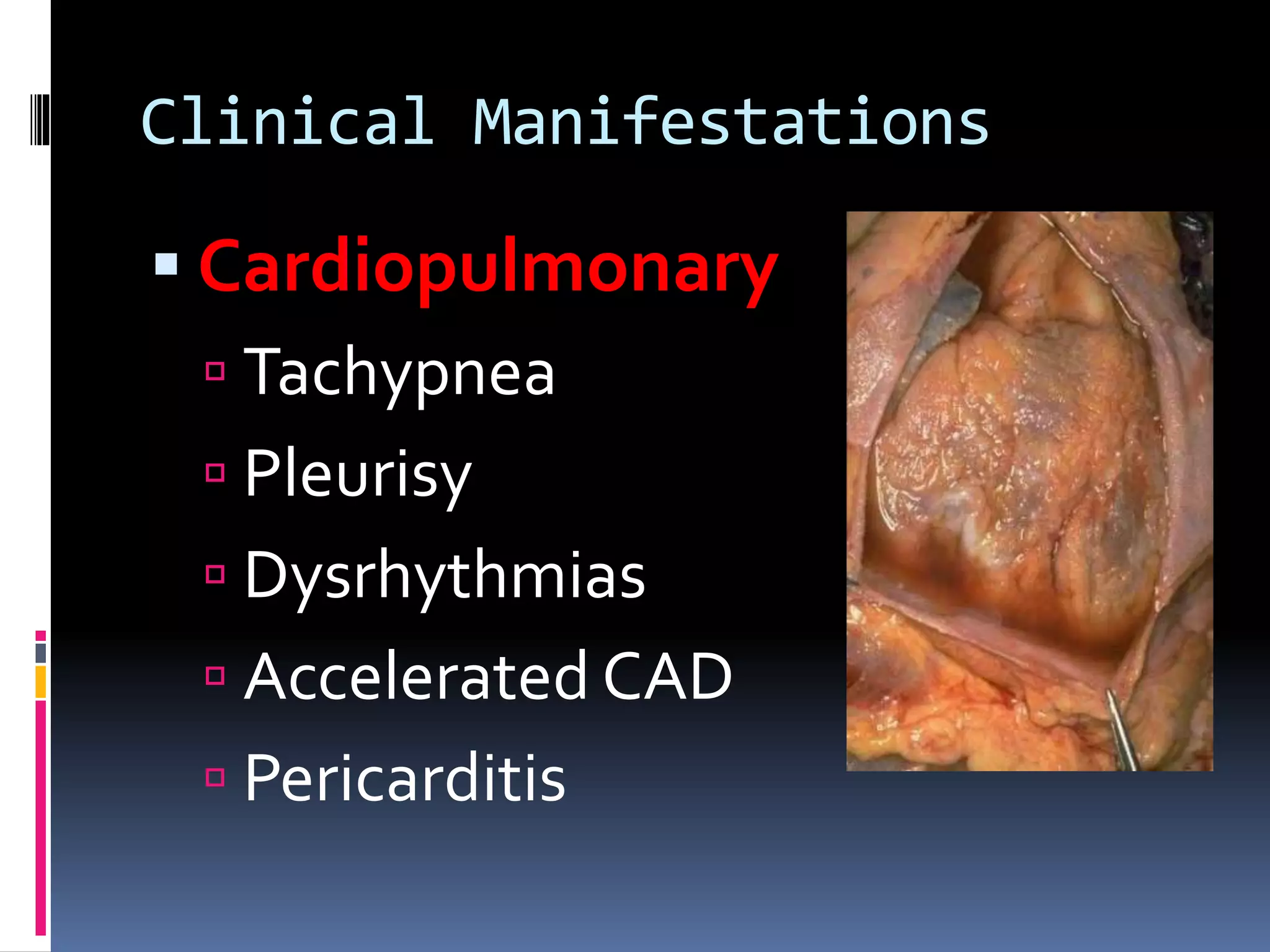 Clinical Manifestations
 Cardiopulmonary
 Tachypnea
 Pleurisy
 Dysrhythmias
 Accelerated CAD
 Pericarditis
 