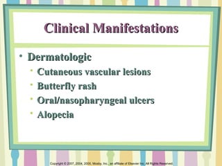 Systemic Lupus Eritematosus | PPT | Blood Disorders | Diseases and ...